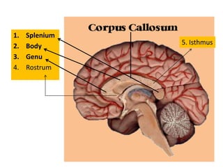 1. Splenium
2. Body
3. Genu
4. Rostrum
5. Isthmus
 