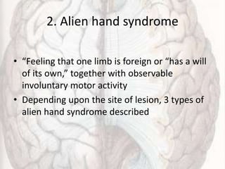2. Alien hand syndrome
• “Feeling that one limb is foreign or “has a will
of its own,” together with observable
involuntary motor activity
• Depending upon the site of lesion, 3 types of
alien hand syndrome described
 