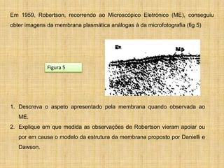 Em 1959, Robertson, recorrendo ao Microscópico Eletrónico (ME), conseguiu
obter imagens da membrana plasmática análogas à da microfotografia (fig 5)
1. Descreva o aspeto apresentado pela membrana quando observada ao
ME.
2. Explique em que medida as observações de Robertson vieram apoiar ou
por em causa o modelo da estrutura da membrana proposto por Danielli e
Dawson.
Figura 5
 