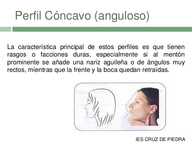 Como no poner en marcha la psoriasis el foro
