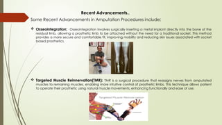 Corrected -Amputation surgery presentation.pptx