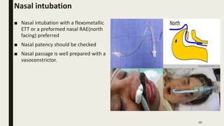 North Facing Rae Anesthesia For Dental surgery | PPTX