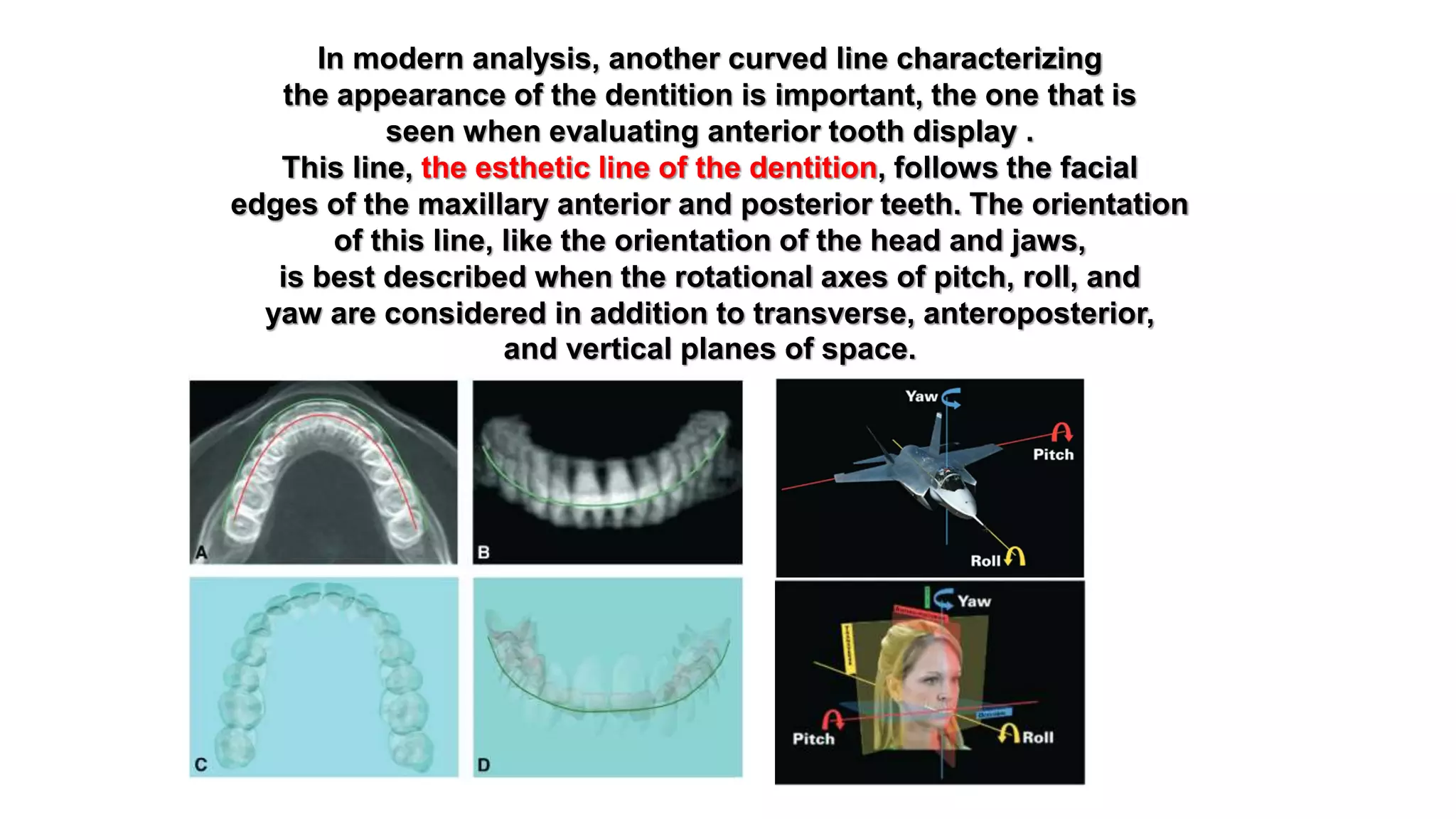 orthodontic correction of canted occlusal plane 2 | PPTX