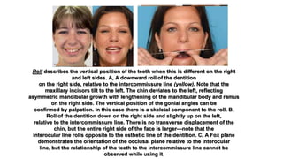 orthodontic correction of canted occlusal plane 2 | PPTX