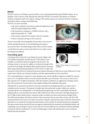 Correction of Keratoconus with GP Lenses | PDF