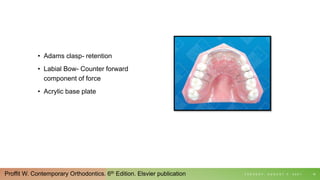 • Adams clasp- retention
• Labial Bow- Counter forward
component of force
• Acrylic base plate
T U E S D A Y , A U G U S T 3 , 2 0 2 1 19
Proffit W. Contemporary Orthodontics. 6th Edition. Elsvier publication
 