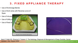 3 . F I X E D A P P L I A N C E T H E R A P Y
• Use of Anchorage Bends
• Use of Arch wires with Reverse curve of
Spee
• Use of intrusion arches
• Use of Utility arches
• Use of fixed anterior bite planes
T U E S D A Y , A U G U S T 3 , 2 0 2 1 25
Naini F, Daljit SG, Sharma S, Tredwin C. The Aetiology, Diagnosis & Management of Deep Overbite. Dental
Updates. July- August 2006.
 