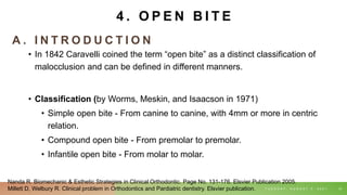 A . I N T R O D U C T I O N
• In 1842 Caravelli coined the term “open bite” as a distinct classification of
malocclusion and can be defined in different manners.
• Classification (by Worms, Meskin, and Isaacson in 1971)
• Simple open bite - From canine to canine, with 4mm or more in centric
relation.
• Compound open bite - From premolar to premolar.
• Infantile open bite - From molar to molar.
T U E S D A Y , A U G U S T 3 , 2 0 2 1 31
4 . O P E N B I T E
Nanda R. Biomechanic & Esthetic Strategies in Clinical Orthodontic. Page No. 131-176. Elsvier Publication 2005.
Millett D, Welbury R. Clinical problem in Orthodontics and Pardiatric dentistry. Elsvier publication.
 