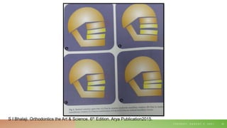 T U E S D A Y , A U G U S T 3 , 2 0 2 1 33
S I Bhalaji. Orthodontics the Art & Science. 6th Edition. Arya Publication2015.
 