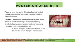 P O S T E R I O R O P E N B I T E
• Posterior open bite can be defined as failure of contact
between the posterior teeth when the teeth occlude in
centric occlusion.
• Causes: 1. Mechanical interference with eruption, either
before or after tooth emerges from alveolar bone.(
ankylosis, trauma, supernumerary teeth, non resorbing
deciduous tooth roots/alveolar bone.)
2. Failure of eruptive mechanism of the tooth so that
the expected amount of eruption does not occur.
T U E S D A Y , A U G U S T 3 , 2 0 2 1 40
Nanda R. Biomechanic & Esthetic Strategies in Clinical Orthodontic. Page No. 131-176. Elsvier Publication 2005.
Millett D, Welbury R. Clinical problem in Orthodontics and Pardiatric dentistry. Elsvier publication.
 