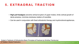 5 . E X T R A O R A L T R A C T I O N
• High pull headgear prevents vertical eruption of upper molars, limits vertical growth of
dento-alveolus: minimize clockwise rotation of mandible.
• Can be used in conjunction with fixed orthodontic therapy and myofunctional appliances.
T U E S D A Y , A U G U S T 3 , 2 0 2 1 63
Graber’s Textbook of Orthodontics Basic Principles & Practices by Shridhar Premkumar.
4th Edition. Elsvier Publication
 