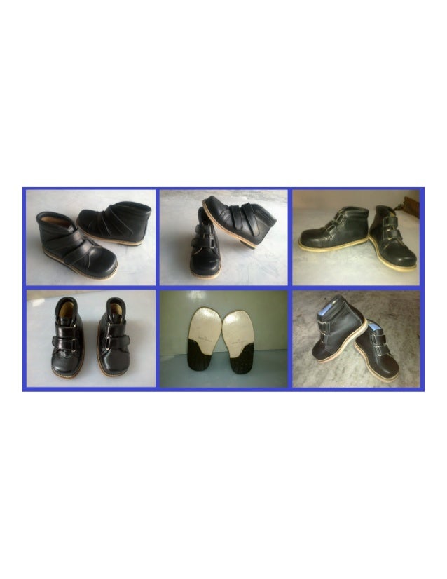 corrective shoes for toe walkers