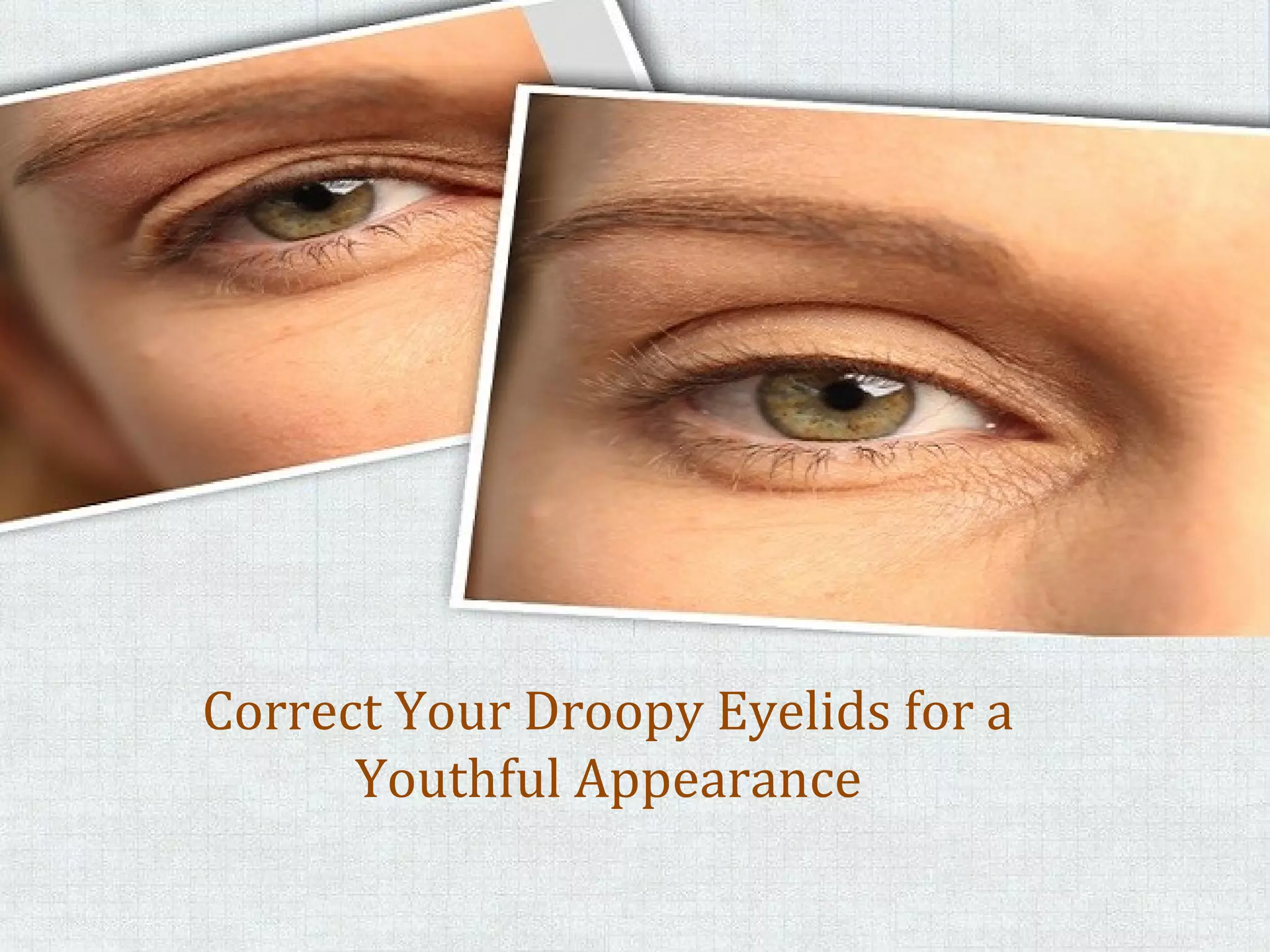 Is Your Face Saying "Sad"? The Shocking Reason Behind Your Droopy Brows - 9jnt3ij
