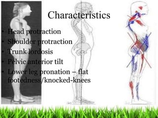 The Importance of the Core in Posture - Dr. Atencio