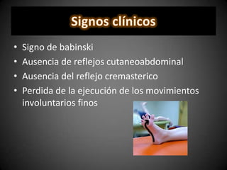 • Signo de babinski
• Ausencia de reflejos cutaneoabdominal
• Ausencia del reflejo cremasterico
• Perdida de la ejecución de los movimientos
involuntarios finos
 