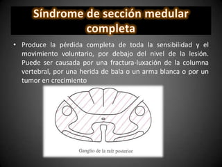 • Produce la pérdida completa de toda la sensibilidad y el
movimiento voluntario, por debajo del nivel de la lesión.
Puede ser causada por una fractura-luxación de la columna
vertebral, por una herida de bala o un arma blanca o por un
tumor en crecimiento
 