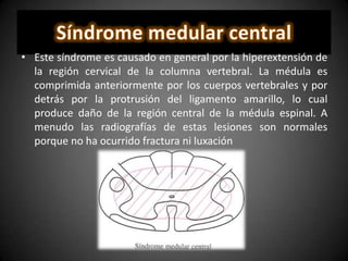 • Este síndrome es causado en general por la hiperextensión de
la región cervical de la columna vertebral. La médula es
comprimida anteriormente por los cuerpos vertebrales y por
detrás por la protrusión del ligamento amarillo, lo cual
produce daño de la región central de la médula espinal. A
menudo las radiografías de estas lesiones son normales
porque no ha ocurrido fractura ni luxación
 