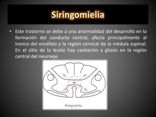 • Este trastorno se debe a una anormalidad del desarrollo en la
formación del conducto central, afecta principalmente al
tronco del encéfalo y la región cervical de la médula espinal.
En el sitio de la lesión hay cavitación y gliosis en la región
central del neuroeje.
 