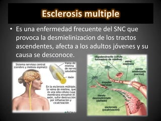 • Es una enfermedad frecuente del SNC que
provoca la desmielinizacion de los tractos
ascendentes, afecta a los adultos jóvenes y su
causa se desconoce.
 