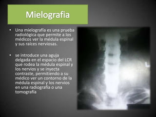 • Una mielografía es una prueba
radiológica que permite a los
médicos ver la médula espinal
y sus raíces nerviosas.
• se introduce una aguja
delgada en el espacio del LCR
que rodea la médula espinal y
los nervios y se inyecta
contraste, permitiendo a su
médico ver un contorno de la
médula espinal y los nervios
en una radiografía o una
tomografía
 