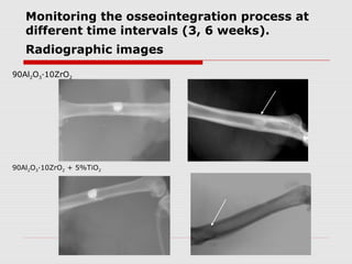 Monitoring the osseointegration process at
   different time intervals (3, 6 weeks).
   Radiographic images

90Al2O3∙10ZrO2




90Al2O3∙10ZrO2 + 5%TiO2
 
