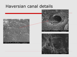 Haversian canal details
 