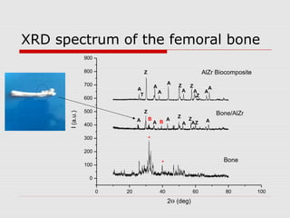 XRD spectrum of the femoral bone
                 900

                 800                 Z                                        AlZr Biocomposite
                 700                                     A
                                             A               Z       Z          A
                                A                                A       A     A
                                                 A
                                 T                                        Z
                 600

                 500                 Z                                              Bone/AlZr
      I (a.u.)




                                         B                   Z     Z
                                A                        A                     A
                 400                         A B                 A AZ

                 300                     *
                 200

                                                     *                                Bone
                 100

                  0

                       0   20                    40                  60                80         100
                                                         2Θ (deg)
 
