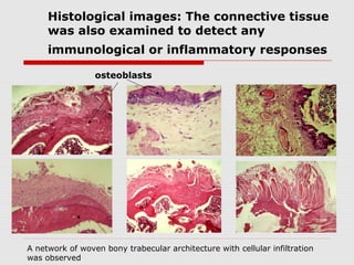 Histological images: The connective tissue
     was also examined to detect any
     immunological or inflammatory responses

                 osteoblasts




A network of woven bony trabecular architecture with cellular infiltration
was observed
 
