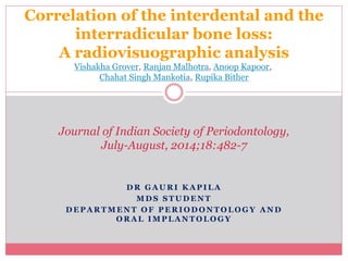 D R G A U R I K A P I L A
M D S S T U D E N T
D E P A R T M E N T O F P E R I O D O N T O L O G Y A N D
O R A L I M P L A N T O L O G Y
Correlation of the interdental and the
interradicular bone loss:
A radiovisuographic analysis
Vishakha Grover, Ranjan Malhotra, Anoop Kapoor,
Chahat Singh Mankotia, Rupika Bither
Journal of Indian Society of Periodontology,
July-August, 2014;18:482-7
 
