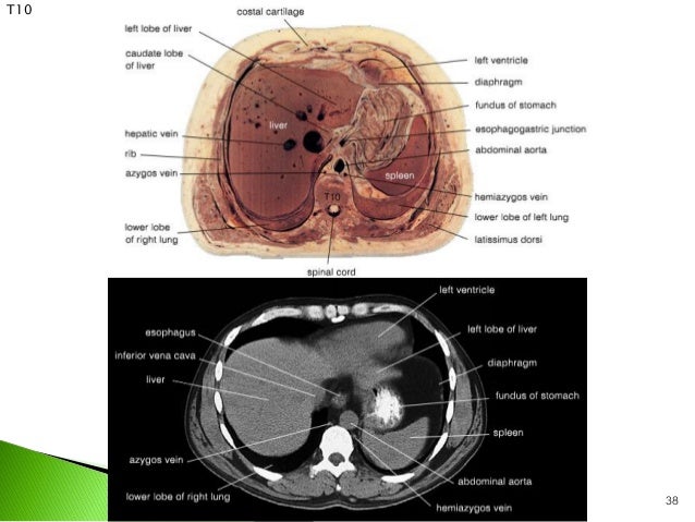 Correlation of Topographic Anatomy with Medical Imagings
