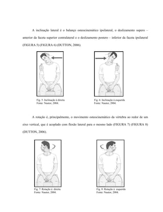 A inclinação lateral é o balanço osteocinemático ipsilateral, o deslizamento supero –

anterior da faceta superior contralateral e o deslizamento postero – inferior da faceta ipsilateral

(FIGURA 5) (FIGURA 6) (DUTTON, 2006).




           Fig. 5: Inclinação à direita                 Fig. 6: Inclinação à esquerda
           Fonte: Nautor, 2004.                         Fonte: Nautor, 2004.




       A rotação é, principalmente, o movimento osteocinemático da vértebra ao redor de um

eixo vertical, que é acoplado com flexão lateral para o mesmo lado (FIGURA 7) (FIGURA 8)

(DUTTON, 2006).




         Fig. 7: Rotação à direita                        Fig. 8: Rotação à esquerda
         Fonte: Nautor, 2004.                             Fonte: Nautor, 2004.
 