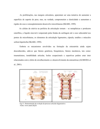 As proliferações, nas margens articulares, aparentam ser uma tentativa de aumentar a

superfície de suporte de peso, mas, na verdade, comprometem a elasticidade e aumentam a

rigidez do osso e conseqüentemente desenvolve microfraturas (SKARE, 1999).

       As células da sinóvia na periferia da articulação tornam – se metaplásicas e produzem

osteófitos, o líquido sinovial é empurrado pelas fendas da cartilagem até o osso subcondral nos

pontos de microfraturas, os elementos da articulação ligamentos, cápsula, tendões e músculos

sofrem hipertrofia (SKARE, 1999).

       Embora os mecanismos envolvidos na formação da osteoartrite ainda sejam

desconhecidos, sabe-se que fatores genéticos, bioquímicos, fatores mecânicos, tais como:

traumatismos, instabilidade articular, lesões ocupacionais e esportivas podem estar inter

relacionados com o efeito do envelhecimento e o desenvolvimento da osteoartrose (ALMEIDA et

al., 2001).




        Fig 11: Demonstração da evolução do processo articular degenerativo
        Fonte: www.anato.ufrj.br
 