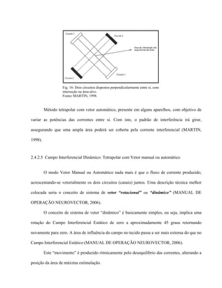 Fig. 16: Dois circuitos dispostos perpendicularmente entre si, com
                   interseção na área-alvo.
                   Fonte: MARTIN, 1998.


         Método tetrapolar com vetor automático, presente em alguns aparelhos, com objetivo de

variar as potências das correntes entre si. Com isto, o padrão de interferência irá girar,

assegurando que uma ampla área poderá ser coberta pela corrente interferencial (MARTIN,

1998).



2.4.2.5 Campo Interferencial Dinâmico: Tetrapolar com Vetor manual ou automático


         O modo Vetor Manual ou Automático nada mais é que o fluxo de corrente produzido,

acrescentando-se vetorialmente os dois circuitos (canais) juntos. Uma descrição técnica melhor

colocada seria o conceito de sistema de vetor “rotacional” ou “dinâmico” (MANUAL DE

OPERAÇÃO NEUROVECTOR, 2006).

         O conceito de sistema de vetor “dinâmico” é basicamente simples, ou seja, implica uma

rotação do Campo Interferencial Estático de zero a aproximadamente 45 graus retornando

novamente para zero. A área de influência do campo no tecido passa a ser mais extensa do que no

Campo Interferencial Estático (MANUAL DE OPERAÇÃO NEUROVECTOR, 2006).

         Este “movimento” é produzido ritmicamente pelo desequilíbrio das correntes, alterando a

posição da área de máxima estimulação.
 