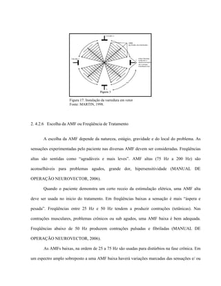 Figura 17: Instalação da varredura em vetor
                    Fonte: MARTIN, 1998.




2. 4.2.6 Escolha da AMF ou Freqüência de Tratamento


      A escolha da AMF depende da natureza, estágio, gravidade e do local do problema. As

sensações experimentadas pelo paciente nas diversas AMF devem ser consideradas. Freqüências

altas são sentidas como “agradáveis e mais leves”. AMF altas (75 Hz a 200 Hz) são

aconselháveis para problemas agudos, grande dor, hipersensitividade (MANUAL DE

OPERAÇÃO NEUROVECTOR, 2006).

      Quando o paciente demonstra um certo receio da estimulação elétrica, uma AMF alta

deve ser usada no inicio do tratamento. Em freqüências baixas a sensação é mais “áspera e

pesada”. Freqüências entre 25 Hz e 50 Hz tendem a produzir contrações (tetânicas). Nas

contrações musculares, problemas crônicos ou sub agudos, uma AMF baixa é bem adequada.

Freqüências abaixo de 50 Hz produzem contrações pulsadas e fibriladas (MANUAL DE

OPERAÇÃO NEUROVECTOR, 2006).

      As AMFs baixas, na ordem de 25 a 75 Hz são usadas para distúrbios na fase crônica. Em

um espectro amplo sobreposto a uma AMF baixa haverá variações marcadas das sensações e/ ou
 