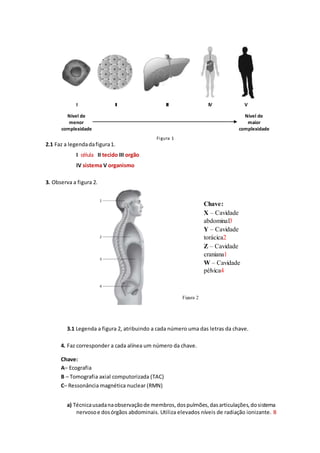 I II III IV V
Nível de
menor
complexidade
Nível de
maior
complexidade
Figura 1
2.1 Faz a legendadafigura1.
I célula II tecido III orgão
IV sistema V organismo
3. Observa a figura 2.
3.1 Legenda a figura 2, atribuindo a cada número uma das letras da chave.
4. Faz corresponder a cada alínea um número da chave.
Chave:
A– Ecografia
B – Tomografia axial computorizada (TAC)
C– Ressonância magnética nuclear (RMN)
a) Técnicausadanaobservaçãode membros,dospulmões,dasarticulações,dosistema
nervosoe dosórgãos abdominais. Utiliza elevados níveis de radiação ionizante. B
Figura 2
Chave:
X – Cavidade
abdominal3
Y – Cavidade
torácica2
Z – Cavidade
craniana1
W – Cavidade
pélvica4
 