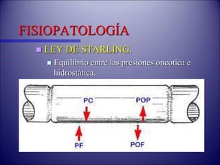 FISIOPATOLOGÍA
 LEY DE STARLING.
 Equilibrio entre las presiones oncótica e
hidrostática.
 