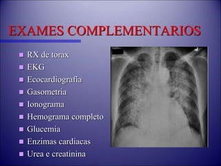 EXAMES COMPLEMENTARIOS
 RX de torax
 EKG
 Ecocardiografía
 Gasometria
 Ionograma
 Hemograma completo
 Glucemia
 Enzimas cardiacas
 Urea e creatinina
 