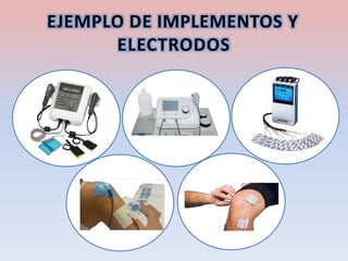EJEMPLO DE IMPLEMENTOS Y
ELECTRODOS
 