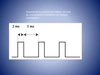Esquema de la corriente de Träbert. Se trata
de una corriente monofásica con impulso
cuadrangular.
 