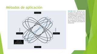 Métodos de aplicación
 