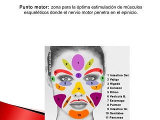 Punto motor: zona para la óptima estimulación de músculos
 esqueléticos donde el nervio motor penetra en el epinicio.
 