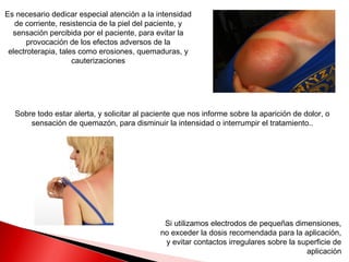 Es necesario dedicar especial atención a la intensidad
   de corriente, resistencia de la piel del paciente, y
  sensación percibida por el paciente, para evitar la
       provocación de los efectos adversos de la
 electroterapia, tales como erosiones, quemaduras, y
                     cauterizaciones




  Sobre todo estar alerta, y solicitar al paciente que nos informe sobre la aparición de dolor, o
      sensación de quemazón, para disminuir la intensidad o interrumpir el tratamiento..




                                              Si utilizamos electrodos de pequeñas dimensiones,
                                             no exceder la dosis recomendada para la aplicación,
                                              y evitar contactos irregulares sobre la superficie de
                                                                                        aplicación
 