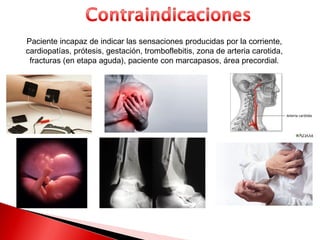 Paciente incapaz de indicar las sensaciones producidas por la corriente,
cardiopatías, prótesis, gestación, tromboflebitis, zona de arteria carotida,
 fracturas (en etapa aguda), paciente con marcapasos, área precordial.
 