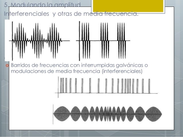 Corrientes mas utilizadas en electroterapia