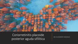 Coriorretinitis placoide
posterior aguda sifilítica
MD ALEXANDER NARANJO
 