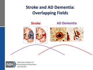 Stroke AD Dementia
Stroke and AD Dementia:
Overlapping Fields
 