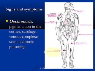 Signs and symptoms

   Oochronosis:
    pigmentation in the
    cornea, cartilage,
    venous complexes
    seen in chronic
    poisoning



                     Dr HEMANTH S NAIK
 