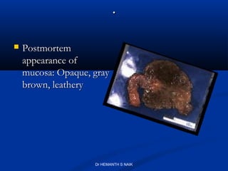 .

   Postmortem
    appearance of
    mucosa: Opaque, gray
    brown, leathery




                    Dr HEMANTH S NAIK
 