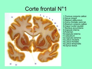Corte frontal N°1 ,[object Object]