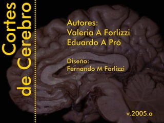 Cortes
de Cerebro   Autores:
             Valeria A Forlizzi
             Eduardo A Pró

             Diseño:
             Fernando M Forlizzi




                                   v.2005.a
 